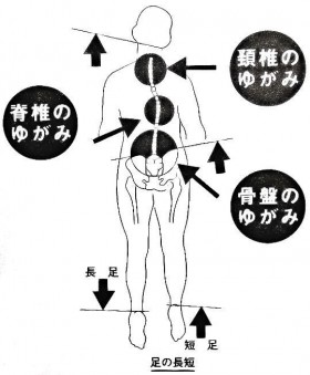 カイロプラクティック